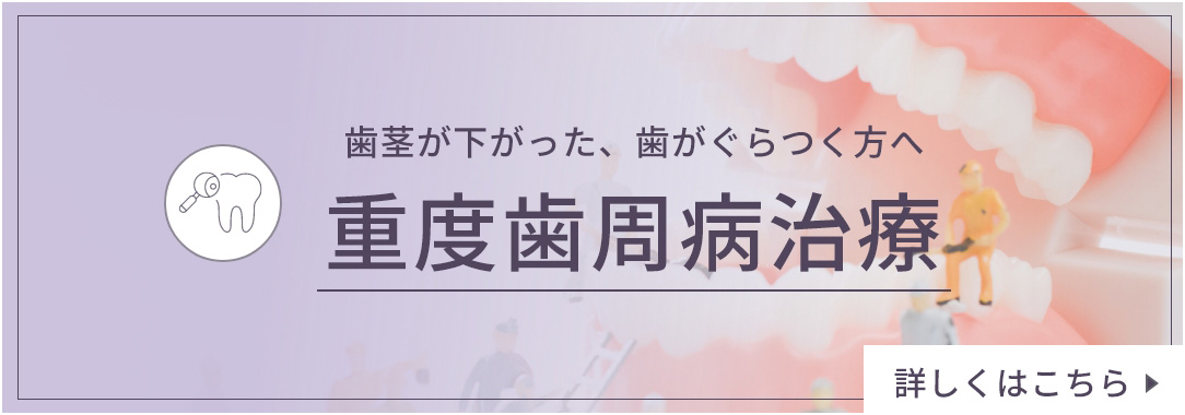 歯茎が下がった、歯がぐらつく方へ 重度歯周病治療